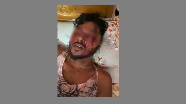 শীর্ষ সন্ত্রসী রাসেলের দু’চোখ উফরে ফেলা হয়েছে