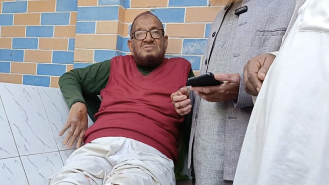 জামায়াতের জনসভায় যাওয়ার পথে সাবেক এমপির ওপর হামলা