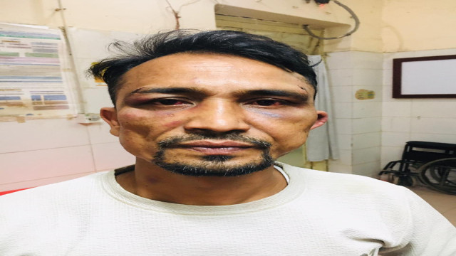 মিরসরাইয়ে প্রবাসীকে মারধর, টাকা ও চেক হাতিয়ে নেওয়ার অভিযোগ